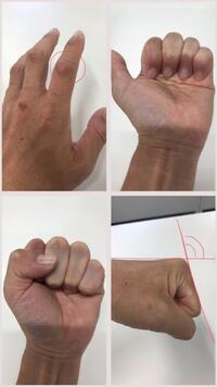 拳に拳ダコや縫い傷がある人は格闘技やケンカしてたのかなと思われるか Yahoo 知恵袋