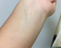 私は 顔に血管 青っぽい 緑っぽい が見えて気持ち悪いです 一 Yahoo 知恵袋