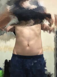 生まれつき骨盤が広いのは治せるんですか 無理かと 矯正して少しは狭く Yahoo 知恵袋