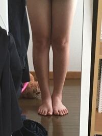これくらいのo脚をまっすぐな脚にすることはできますか 私は目が見えない Yahoo 知恵袋
