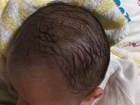 生後３ヶ月の赤ちゃんで最近自分の髪の毛を手でむしって その髪の毛のつ Yahoo 知恵袋