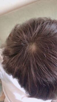これはつむじハゲですか 歳学生です 髪の毛は軟毛で Yahoo 知恵袋