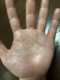 薬指の下に四角とスターらしきものがあります ネットで調べて良 Yahoo 知恵袋
