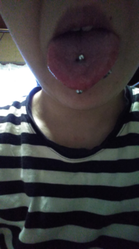 先日舌ピアスを開けました 場所はセンタータンです ものすごく腫れて固 Yahoo 知恵袋