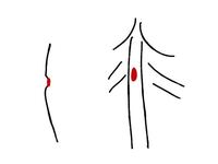切れ チン 子 た 皮 の