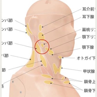 リー 病気だと思う 致死 首 の リンパ腫 れる 原因 Pinx Jp