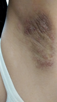 観覧注意です これは私の脇です すごく汚いです ワキガ Yahoo 知恵袋