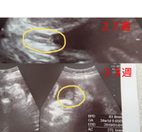33週 初産婦です エコーでの性別判定をお願いします 27週 Yahoo 知恵袋