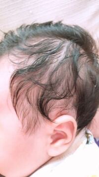 １ヶ月の子供の髪質について息子の髪の毛なのですが 父親が軽い天パなので Yahoo Beauty