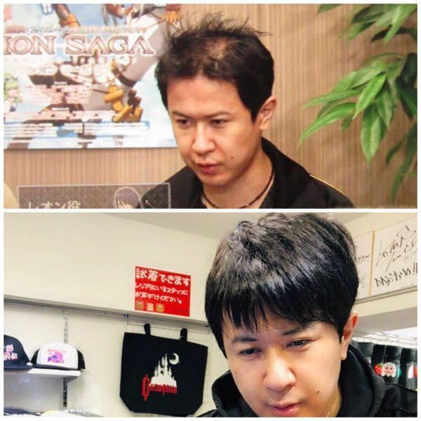 声優杉田智和さんの毛髪は復活しましたか 私も思った笑3 Yahoo 知恵袋