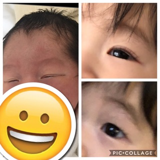 将来二重になる可能性あるでしょうか 9か月の赤ちゃんです 普 Yahoo 知恵袋 将来二重になる可能性あるでしょうか 9か月の赤ちゃんです 普 Yahoo 知恵袋