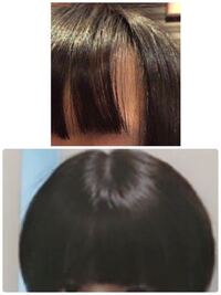 今前髪の両サイドがハゲていて とても困っています 今高1です 心当たりのある原 Yahoo 知恵袋