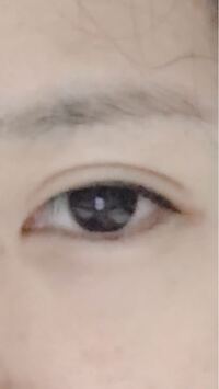 黒目が大きいのは病気 黒目の大きさは皆同じと言われたのですが 自分は黒 Yahoo 知恵袋
