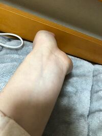 血管の色でブルベかイエベかわかるらしいのですが この色は緑で Yahoo 知恵袋