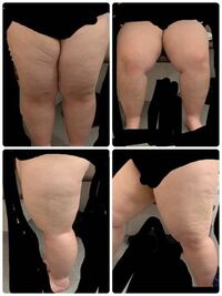 大変お見苦しい写真載せます私はとてつもなくふとももが太いです 全身ふと Yahoo 知恵袋