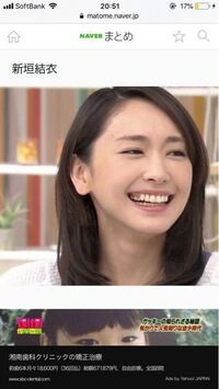 新垣結衣さんの歯はガミースマイルの治療途中で変だったのですか Yahoo 知恵袋