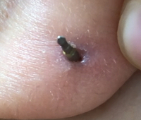 ファーストピアス 3時間ほど外すと穴は塞がりますか １週間ほど Yahoo 知恵袋