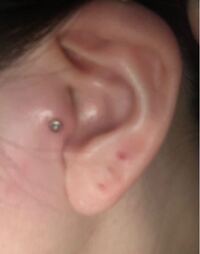 セプタムピアスセルフ位置についてなんですが軟骨に開けるのか 軟骨の Yahoo 知恵袋