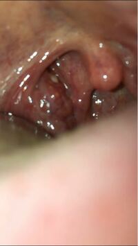 奥 臭い 違和感 喉 の 喉のつかえ(喉の異常感)｜診察室でよくみる大人の病気