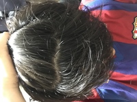 髪の毛を濡らすと前頭部の地肌がかなりみえます 乾いてる状態だとあま Yahoo 知恵袋