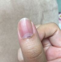 甘皮か黒くなっていたので甘皮を少しずつ下ろしたらこのような感 Yahoo 知恵袋