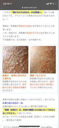 閲覧注意 男子高校生です 先週ほどから陰部が痒くて季節的にも いん Yahoo 知恵袋