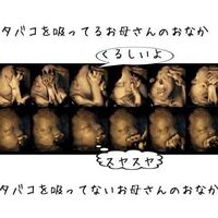 妊娠中にタバコを吸っていても タバコを吸っている女性自身は全 Yahoo 知恵袋