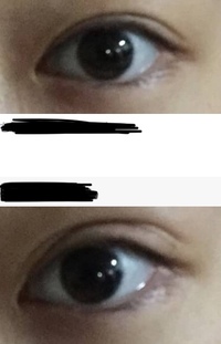 二重全切開に失敗されて三重になってしまいました 修正をしようと思って Yahoo 知恵袋