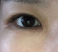 黒目が大きい男性 女性は魅力的ですよね 大きすぎるわけ Yahoo 知恵袋