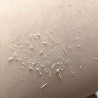 閲覧注意 お風呂上がりに体を拭いていたら白いものが出てきたんで Yahoo 知恵袋