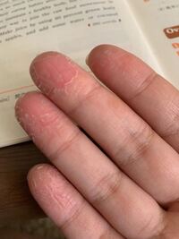 洗い場手荒れ居酒屋でバイトしてるバンドマンです ホール ドリンク 洗い物をやる Yahoo 知恵袋