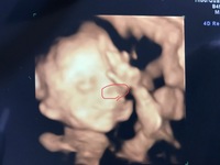 赤ちゃんのエコー写真について質問です 妊娠7ヶ月になり今日初 Yahoo 知恵袋