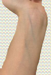 血管緑ですか パーソナルカラー診断の参考にしたいです Yahoo 知恵袋