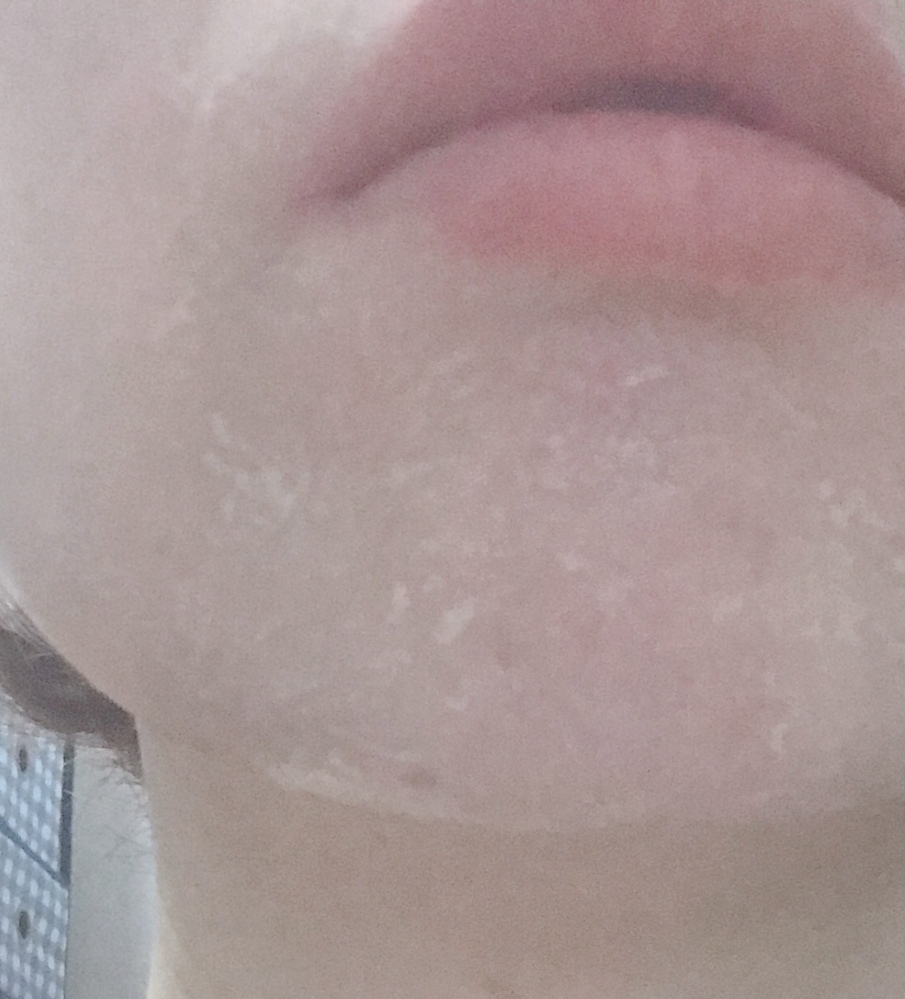 70以上 洗顔 後 白い カス