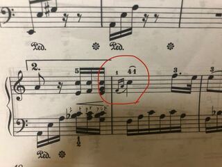 エリーゼのためにの楽譜なんですけど ここはどういう風に弾けばいいですか Yahoo 知恵袋