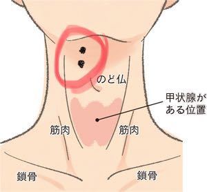 積分 のヒープ 聖人 首 しこり 動く Omutamachikyo Jp