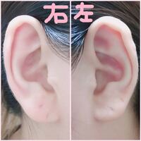 ピアスをあけたい30代主婦です でもあけるのが怖いんです はるか10年ほど前に Yahoo 知恵袋