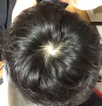 19歳男です つむじ2つあります 入浴後髪乾かして くしでぺったん Yahoo 知恵袋