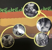 誤飲について７ヶ月の息子どうやらシールを飲み込んだような気がしてなり Yahoo 知恵袋