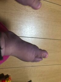 冷えると足の色がいつも悪いです 生後6ヶ月の娘です 大 Yahoo 知恵袋