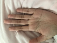 手のひらのシワが人より多いです 小さいころからシワが多くて お婆ちゃん Yahoo 知恵袋