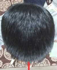 頭の形がいびつでしょうか 後頭部が左右均等じゃないのが気になります 画 Yahoo 知恵袋