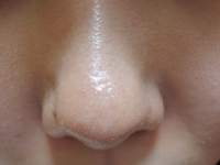 メイクをするとき 下地を塗ると 鼻の角質 白いプツプツ が浮き上が Yahoo 知恵袋