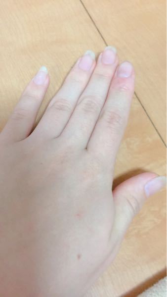 至急おねがいします この爪の長さで長さ出しできますか Yahoo 知恵袋