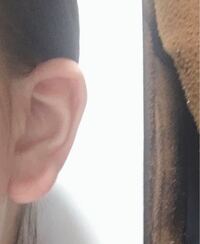 福耳で貧乏な人いますか 前に報道番組でインタビューされ Yahoo 知恵袋