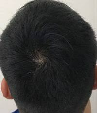 頭髪 薄い 頭髪 薄い 髪型