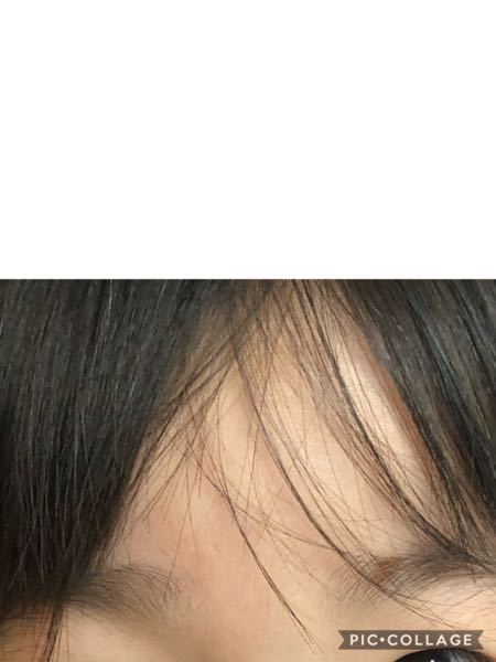 ほくろ占いについてです 娘の眉毛の中に黒子があります 大きめで Yahoo 知恵袋
