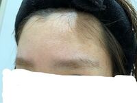 眉毛を剃ったら剃った所の黒いぶつぶつが目立ってしまいました Yahoo 知恵袋