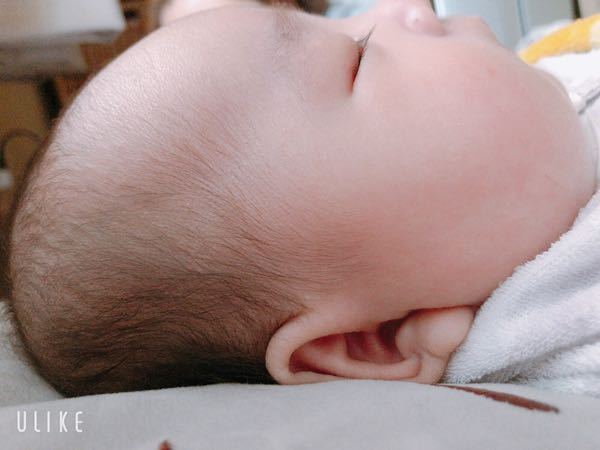 赤ちゃんの頭が長いです… 明日で生後2ヶ月の男の子です。... Yahoo!知恵袋