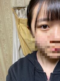 友達が整形しました 目が重い一重からぱっちり二重に 元々アイ Yahoo 知恵袋